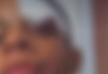 Menino de 11 anos é agredido por colegas em escola de Camaçari