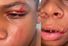 Afastamento de diretoras em Camaçari após agressão em escola!