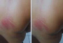 Neurodivergência: Criança é agredida em escola de Camaçari