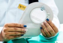 Atendimento Especializado para Ostomizados em Camaçari: Descubra!